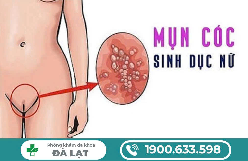 Hình ảnh minh họa