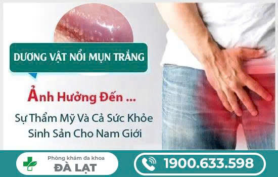 Hình ảnh minh họa