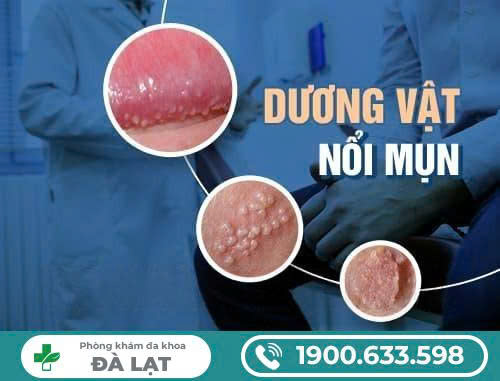 Hình ảnh minh họa