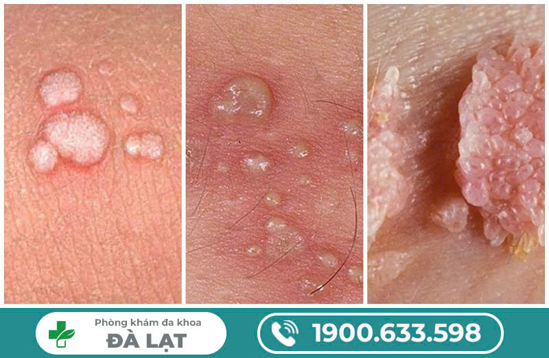 Hình ảnh minh họa