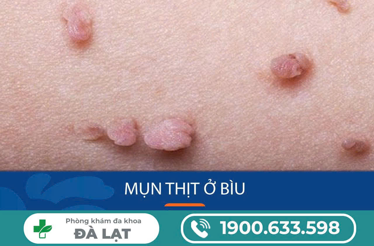 Hình ảnh minh họa