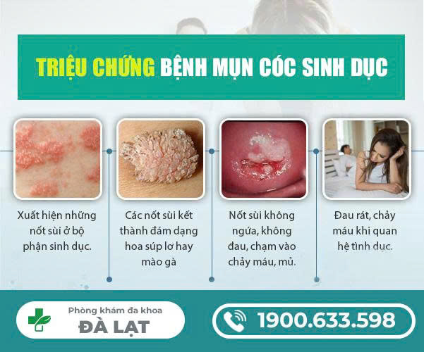 Hình ảnh minh họa