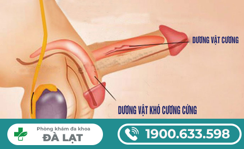 Hình ảnh minh họa