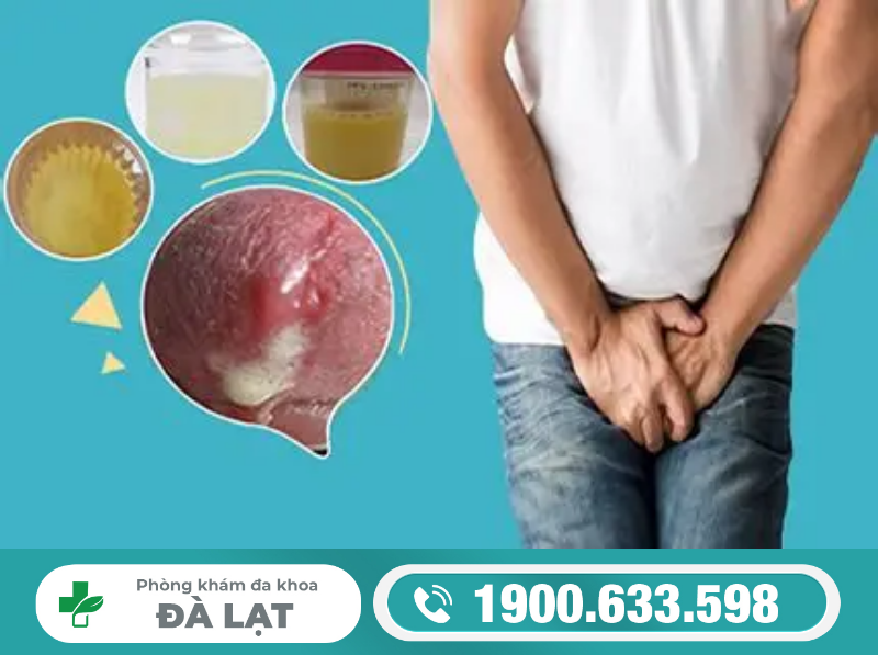 Hình ảnh minh họa