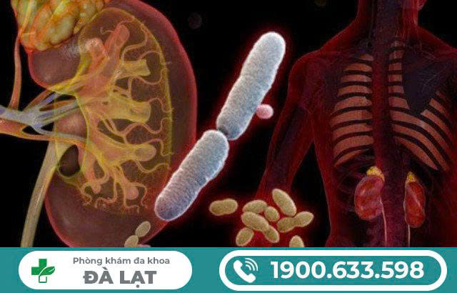 Hình ảnh minh họa