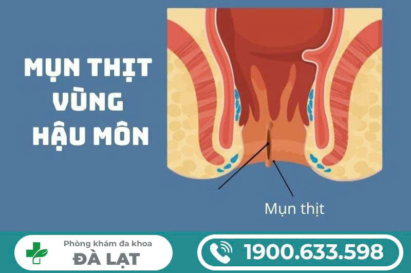 Hình ảnh minh họa