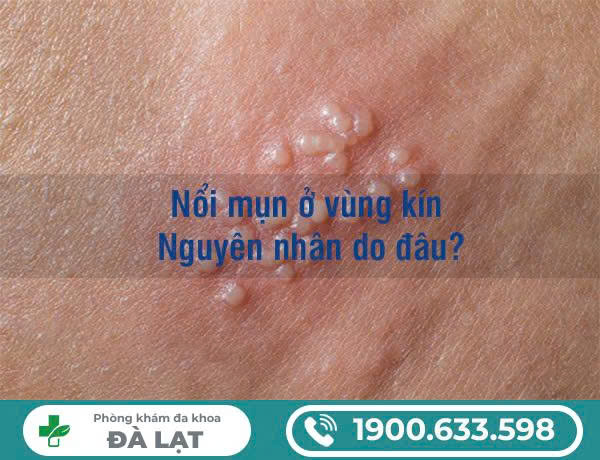 Hình ảnh minh họa