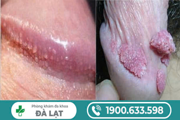 Hình ảnh minh họa