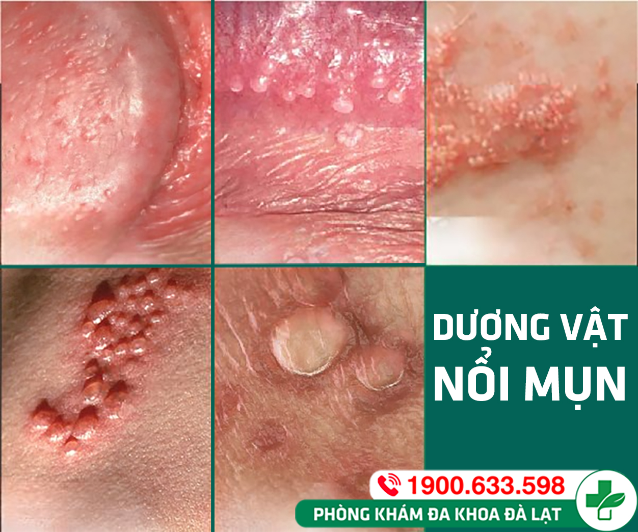 Hình ảnh minh họa