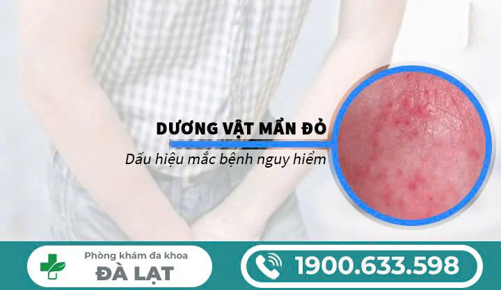 Hình ảnh minh họa