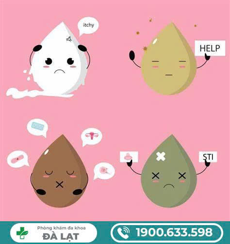 Hình ảnh minh họa