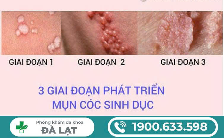 Hình ảnh minh họa