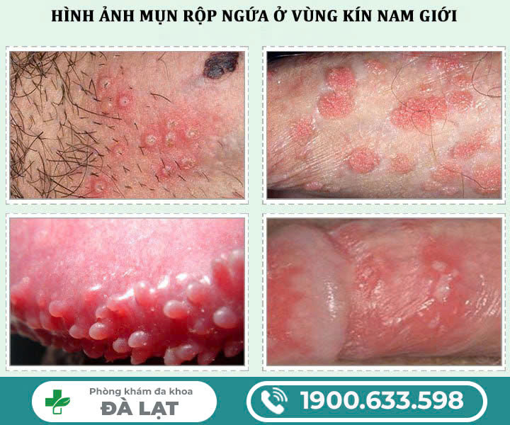 Hình ảnh minh họa