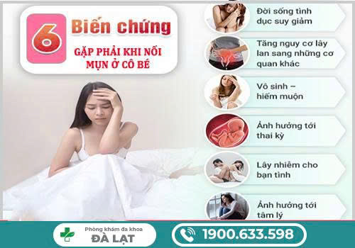 Hình ảnh minh họa