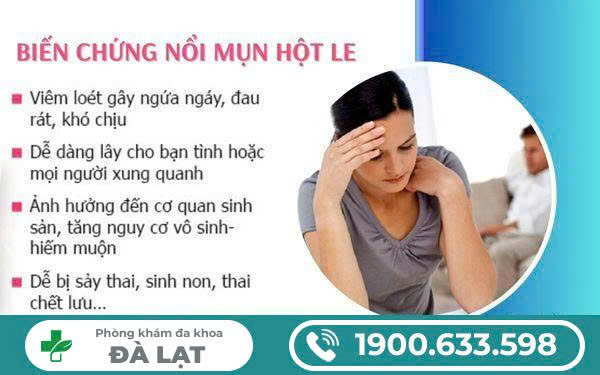 Hình ảnh minh họa