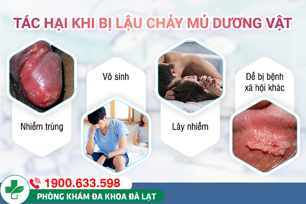 Hình ảnh minh họa