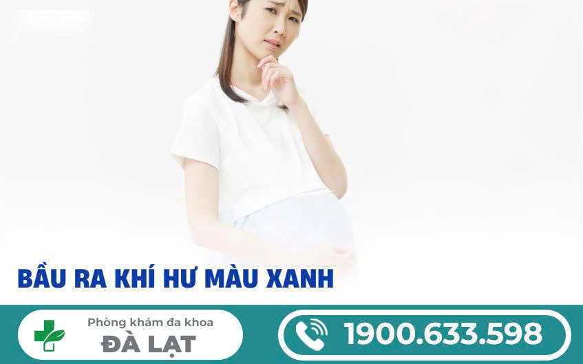 Hình ảnh minh họa