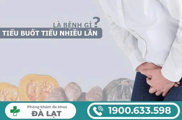 Hình ảnh minh họa