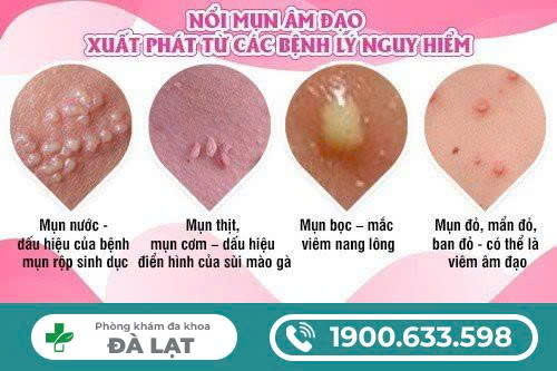 Hình ảnh minh họa