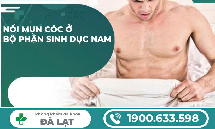 Hình ảnh minh họa