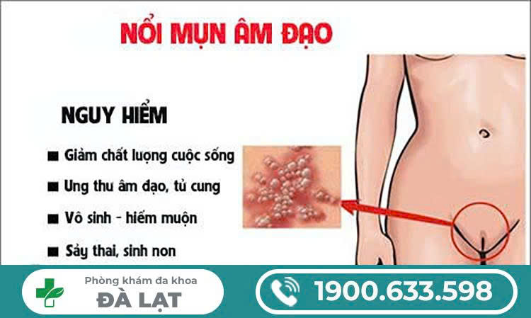 Hình ảnh minh họa