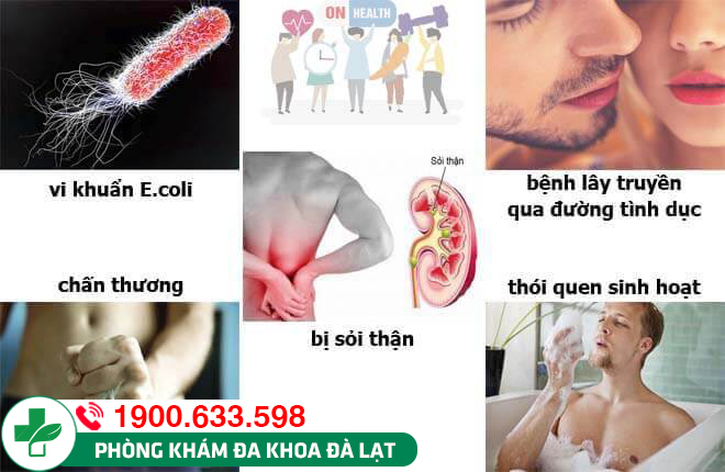 Hình ảnh minh họa