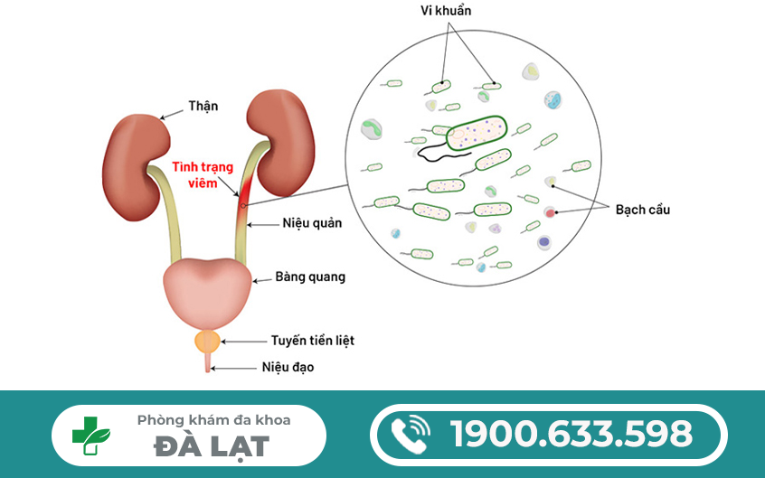 Hình ảnh minh họa