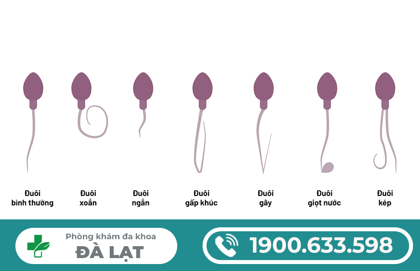 Hình ảnh minh họa