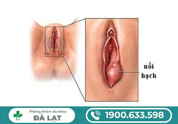 Hình ảnh minh họa