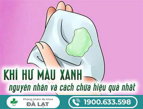 Hình ảnh minh họa