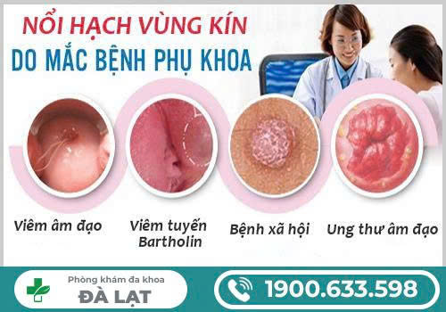 Hình ảnh minh họa