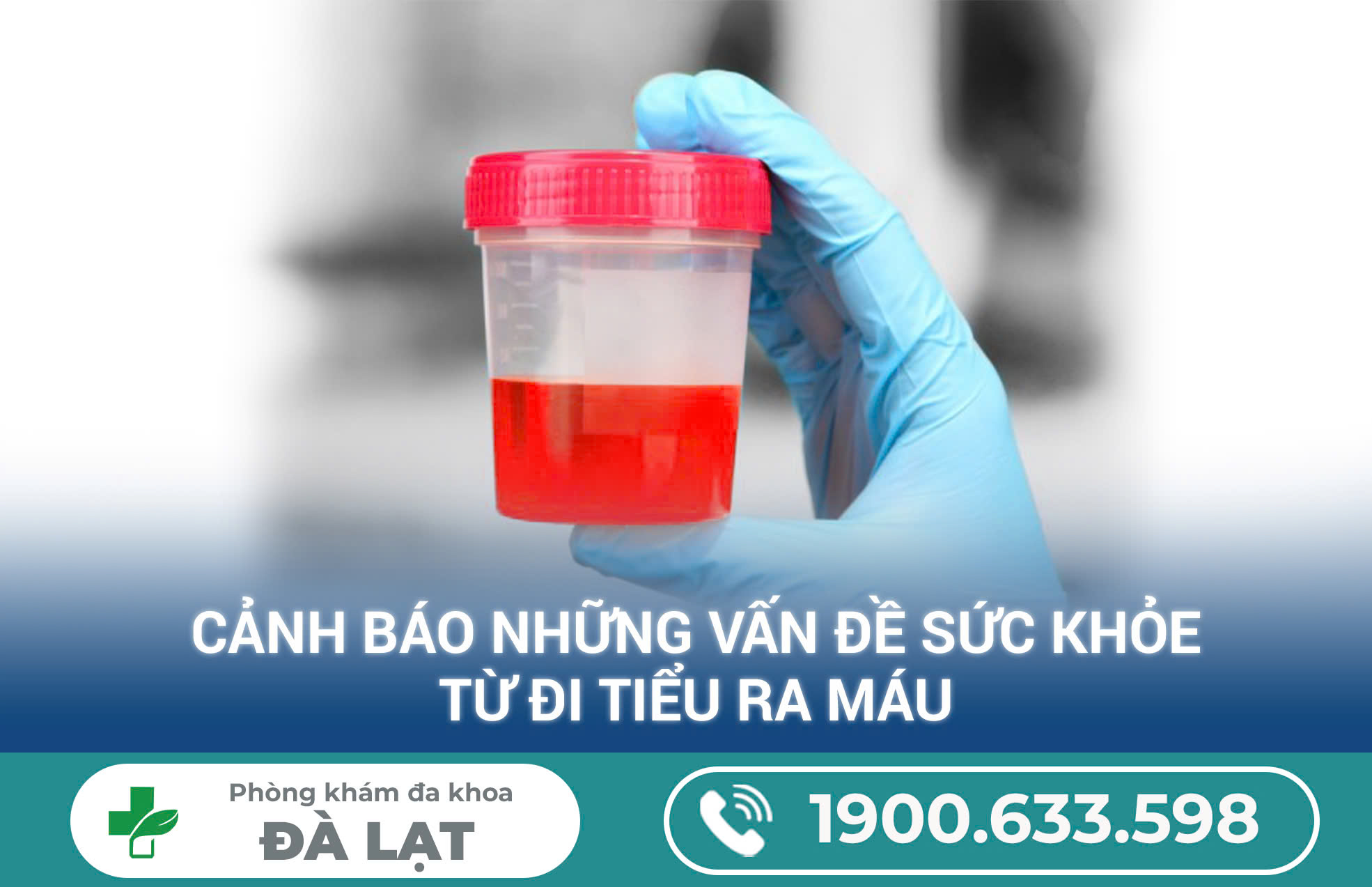 Hình ảnh minh họa