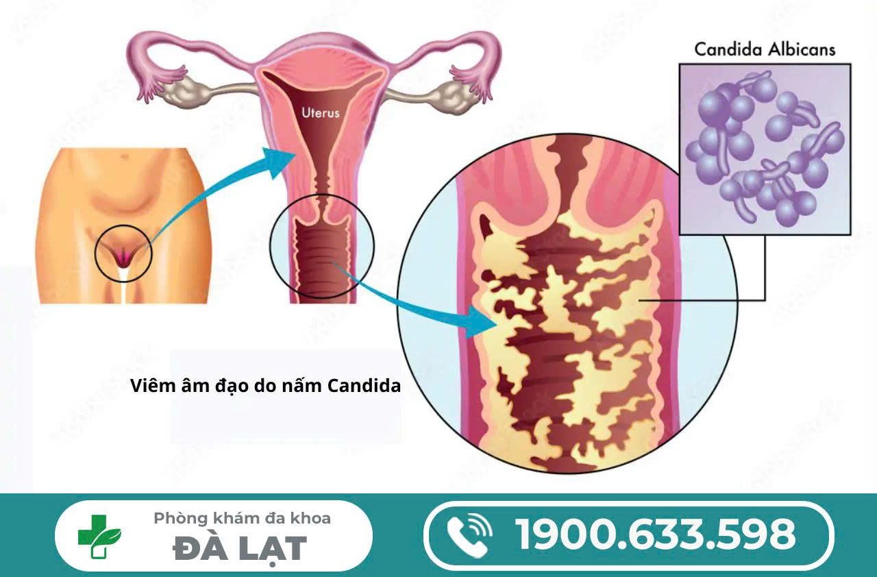 Hình ảnh minh họa