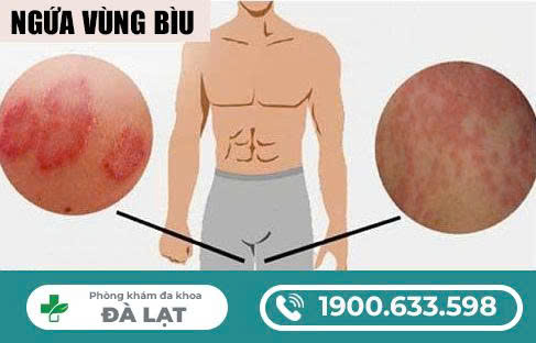 Hình ảnh minh họa