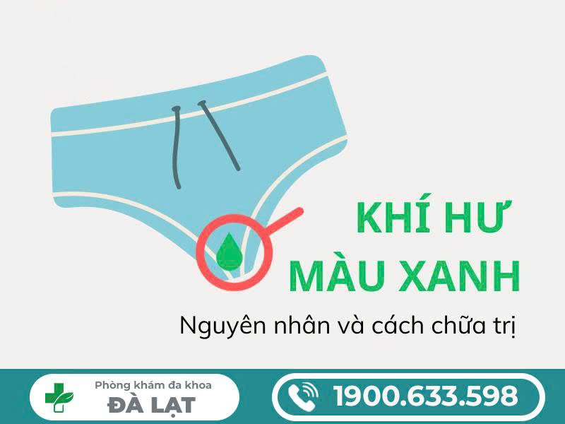 Hình ảnh minh họa