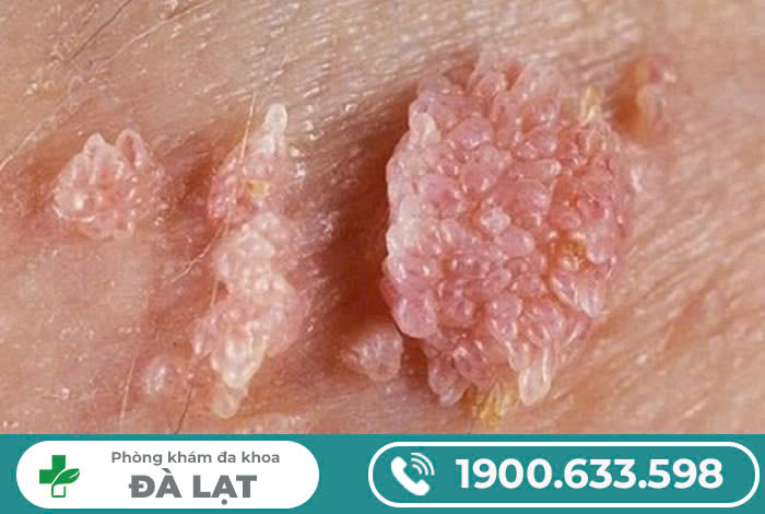 Hình ảnh minh họa