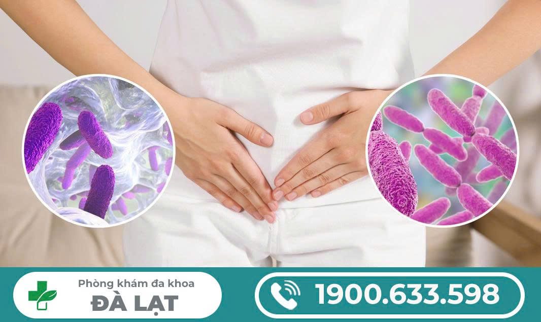 Hình ảnh minh họa