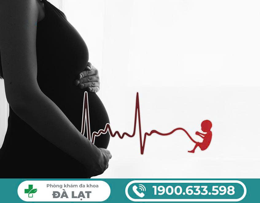 Hình ảnh minh họa