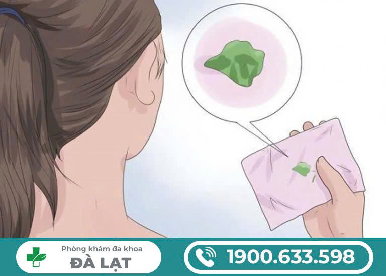 Hình ảnh minh họa