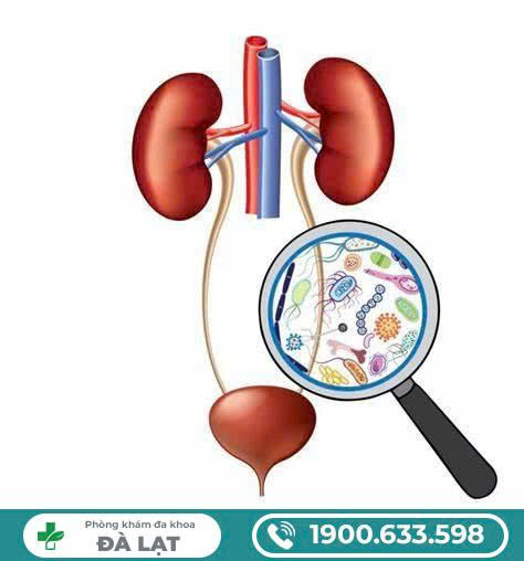 Hình ảnh minh họa