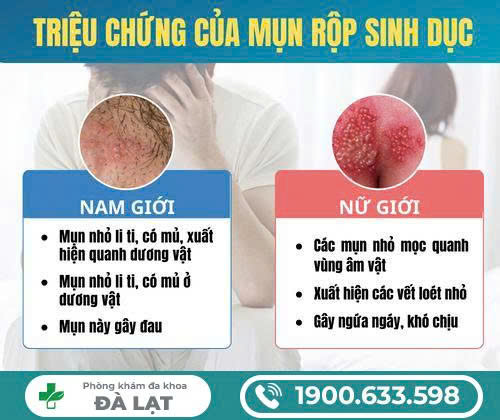 Hình ảnh minh họa