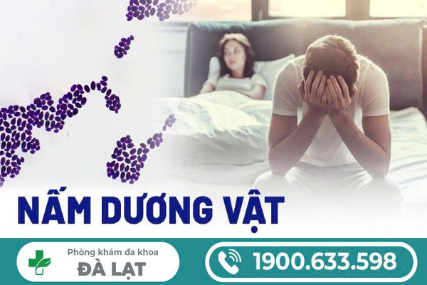 Hình ảnh minh họa