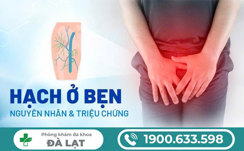 Hình ảnh minh họa