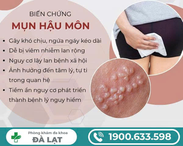 Hình ảnh minh họa