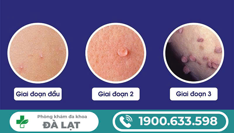 Hình ảnh minh họa