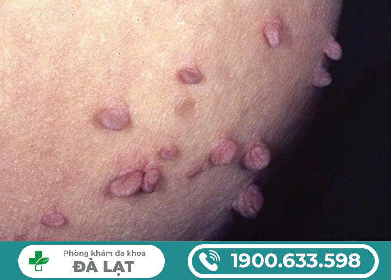 Hình ảnh minh họa