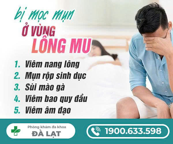 Hình ảnh minh họa