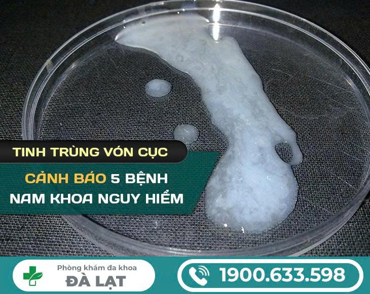 Hình ảnh minh họa