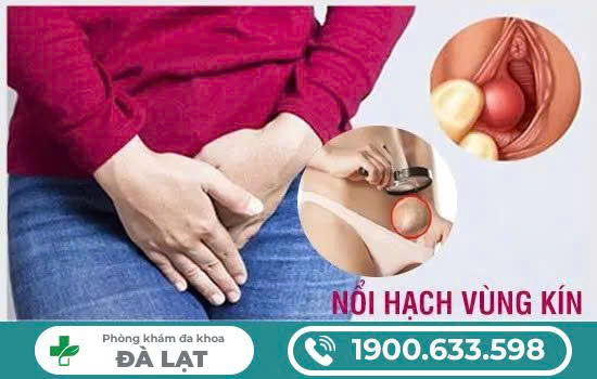 Hình ảnh minh họa