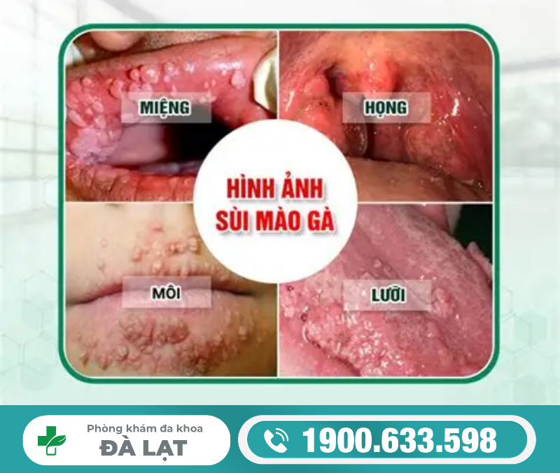 Hình ảnh minh họa